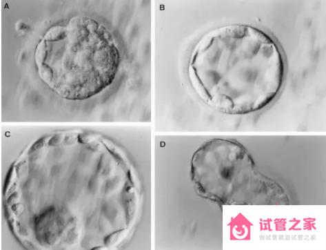 囊胚等級示意圖