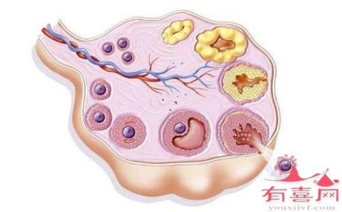 雌二醇低說明是空*泡嗎