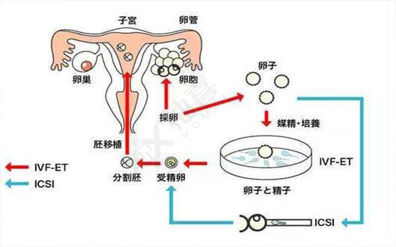 胚胎移植