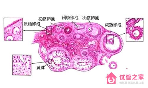 避免患者自行排*，提高試管成功率