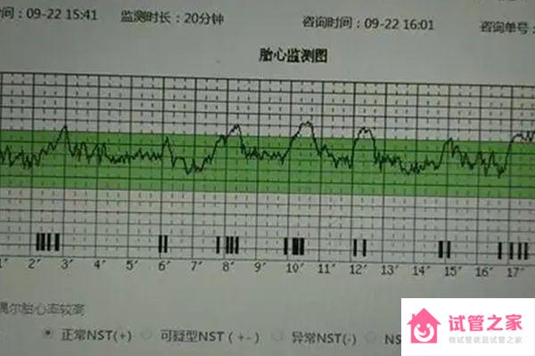 鑒定胎兒性別方法