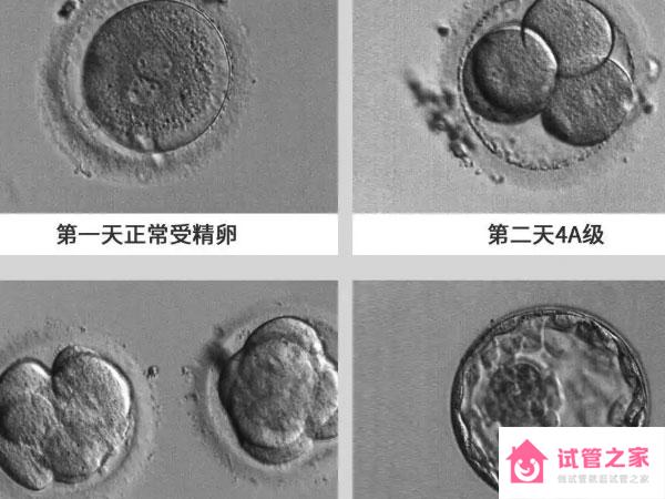 養(yǎng)囊一般是5-7天出結(jié)果