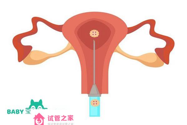 攝圖網(wǎng)_306448706_Uterus和胚胎轉(zhuǎn)移人工授精孤立女器官體外授精孕育現(xiàn)*醫(yī)藥注射器和生殖系統(tǒng)外科手術(shù)胚胎轉(zhuǎn)移人工授精子宮和*孤立器官（企業(yè)商用）.jpg