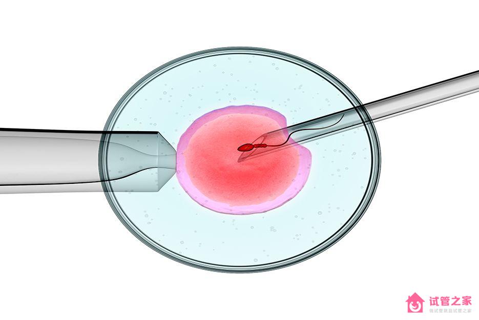 試管ivf