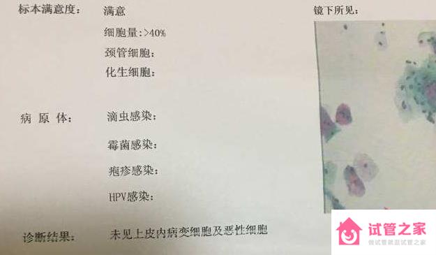 tct檢查結(jié)果有幾種