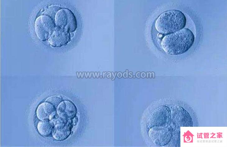 試管嬰兒鮮胚胎、凍胚、囊胚區(qū)別在哪