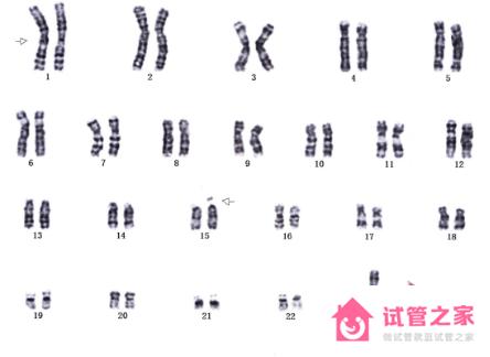 怎么解讀染色體核型分析報(bào)告