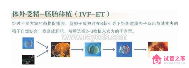 第三*試管嬰兒就會適合你嗎？這些區(qū)別你一定要知道！