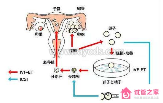 第三*試管嬰兒就會適合你嗎？這些區(qū)別你一定要知道！