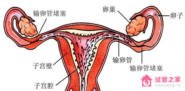 這3種情況容易導(dǎo)致試管嬰兒失敗，希望你沒有！