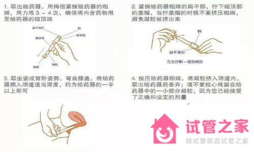 使用雪諾同塞藥的正確姿勢(shì)是什么