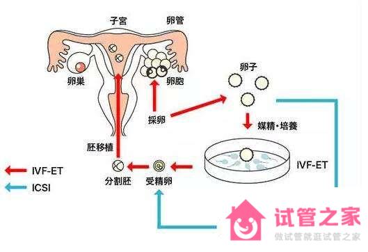 為了你，我們整理了美國供*試管嬰兒流程和時(shí)間