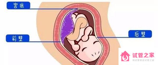 1分鐘了解胎盤前壁和后壁的3大區(qū)別，為孕期做好準備