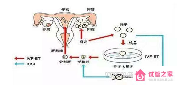 泰國輔助生殖技術(shù)有哪些?第一*，第二*，第三*試管