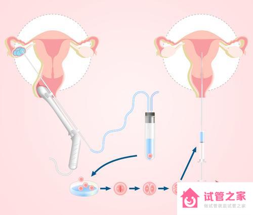 人工授精費(fèi)用是多少