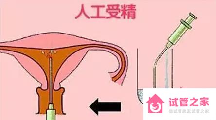 到底人授好還是直接做試管好