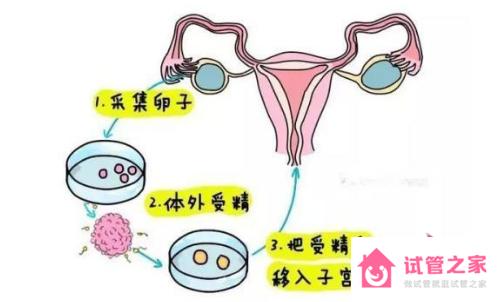 兩個(gè)女生試管嬰兒怎么做的