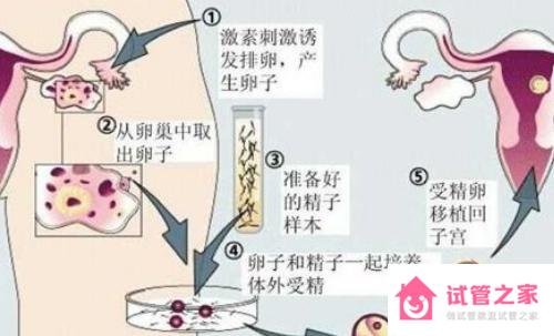 國內(nèi)單身未婚女人可以去買精子做試管嬰兒嗎