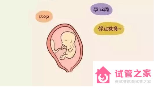 多次胎停流產(chǎn)可以做第三*試管嬰兒?jiǎn)?