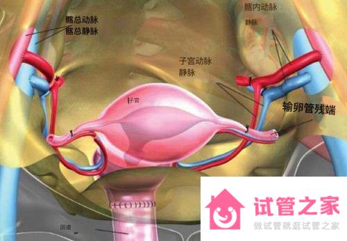 做試管嬰兒時(shí)宮腔灌注是什么意思？