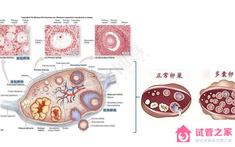 必懂！多囊*巢綜合癥不可以長期吃媽富隆治療