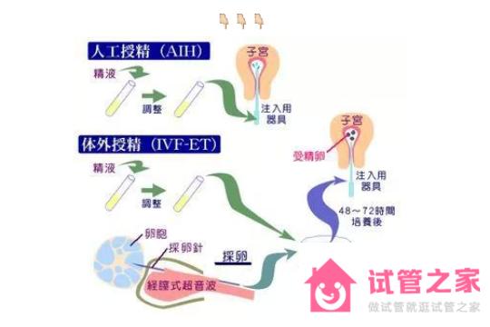 做試管嬰兒備孕要如何鍛煉身體