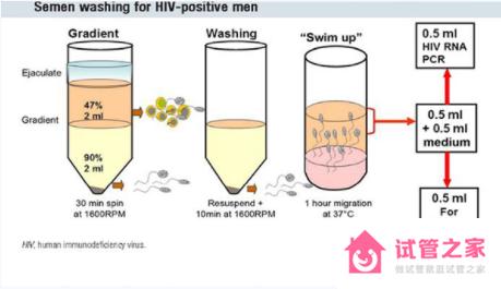 人工授精精子能洗掉傳染病嗎 hiv精子洗滌技術(shù)的流程