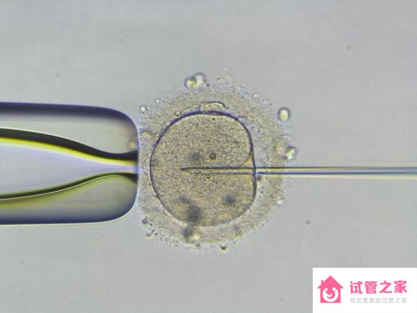 2023鹽城試管嬰兒費用大約多少，附檢查、促排費用預(yù)估