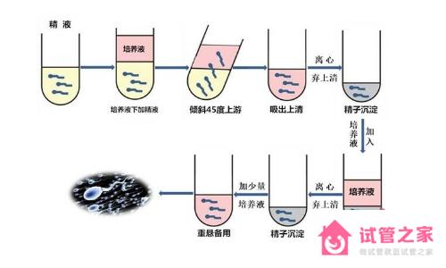 精子dna碎片率高的原因是什么