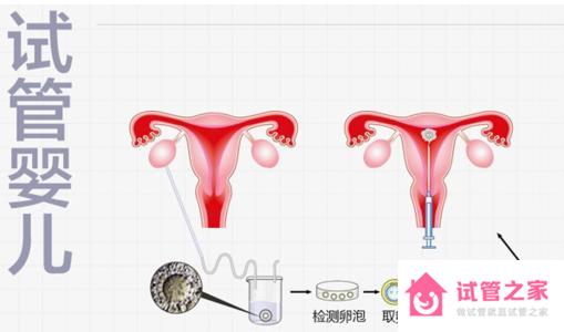 泰國(guó)試管嬰兒總費(fèi)用是多少