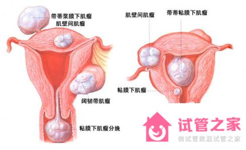 第三*試管嬰兒成功率是多少