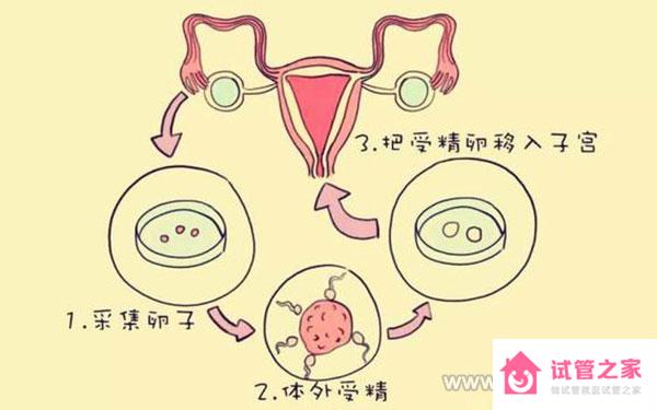 雙子宮在南昌哪家醫(yī)院做試管比較好？