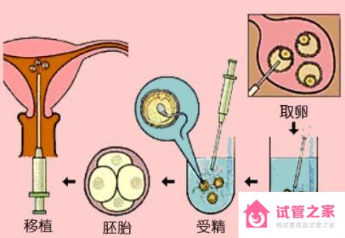 試管成功率如何才能到達(dá)100%？