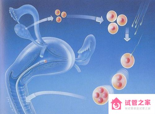 高齡女性能做試管嬰兒嗎?