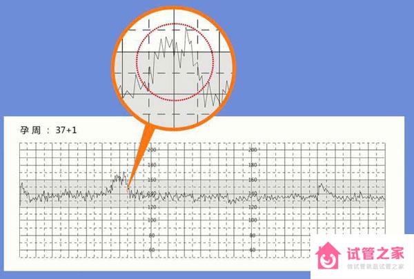 看胎心率
