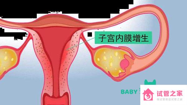 子宮內(nèi)膜增生癥的臨床表現(xiàn)有哪些？