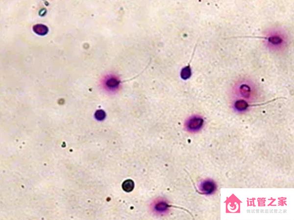 精子dna碎片化檢測(cè)和染色體體檢有什么區(qū)別？