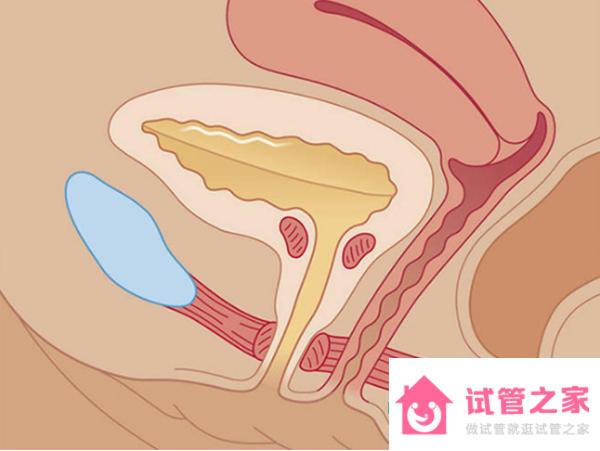 幼稚子宮有哪些癥狀？月經(jīng)稀少別再不重視了！