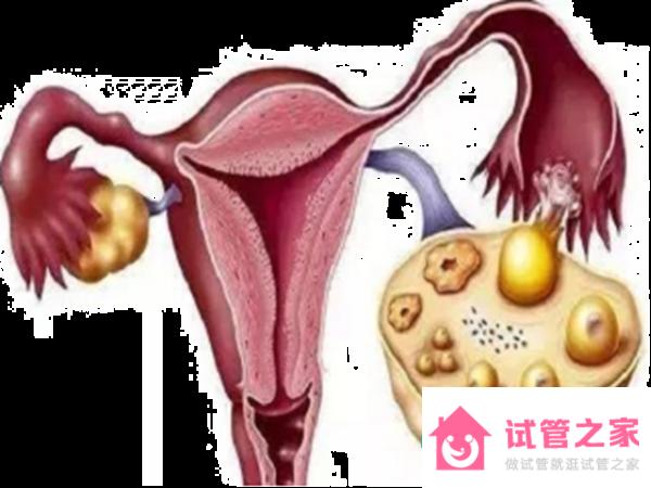 29歲女性*巢早衰還能懷孕嗎？能自然受孕嗎？