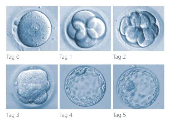 試管嬰兒胚胎等級(jí)8c質(zhì)量怎么樣?