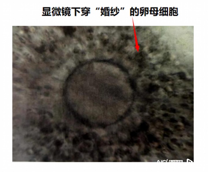 從生殖細胞到孕育&ldquo;成人&rdquo;，胚胎學家的操作科技感爆棚 ...