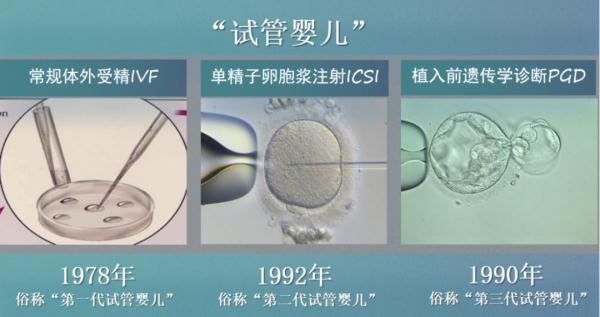 輔助生殖技術(shù)發(fā)展到了哪一步？