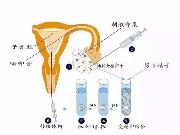 第一*、第二*、第三*試管嬰兒技術(shù)，該怎么選？