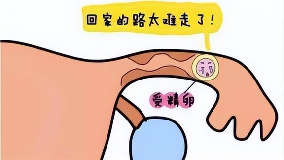 宮外孕是怎么一回事？很嚴(yán)重嗎？