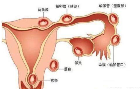 宮外孕不得已手術(shù)，婆婆第一句話還能生么，我想抱孫子