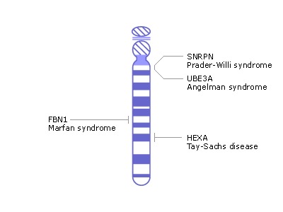 染色體圖譜.23對(duì)染色體對(duì)應(yīng)的疾病