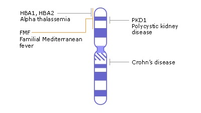 染色體圖譜.23對(duì)染色體對(duì)應(yīng)的疾病