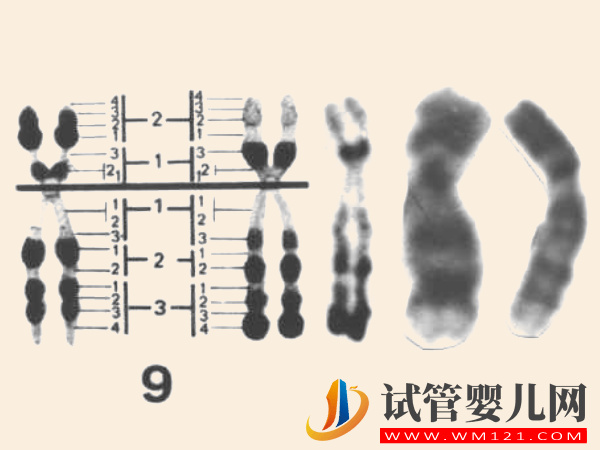 9號(hào)染色體決定什么：出現(xiàn)嵌合、三體等異常后果很嚴(yán)重