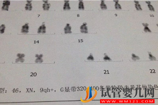 9號(hào)染色體決定什么：出現(xiàn)嵌合、三體等異常后果很嚴(yán)重