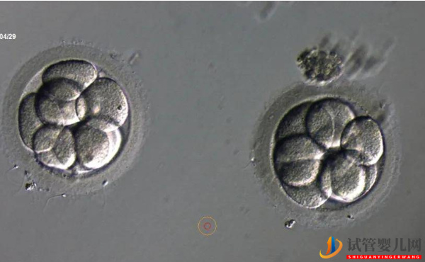 2pn胚胎是不是優(yōu)質(zhì)胚胎？移植成功率說明了一切